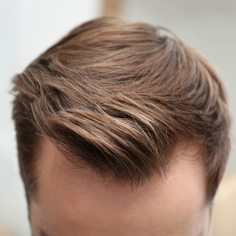 Close-up of styled natural men’s hair representing BarberNBar’s non-surgical hair system services in Cheltenham.