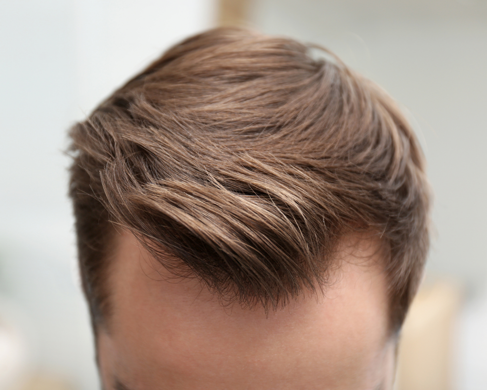 Men’s Hair Systems: Everything You Need to Know for a Natural Look and Renewed Confidence