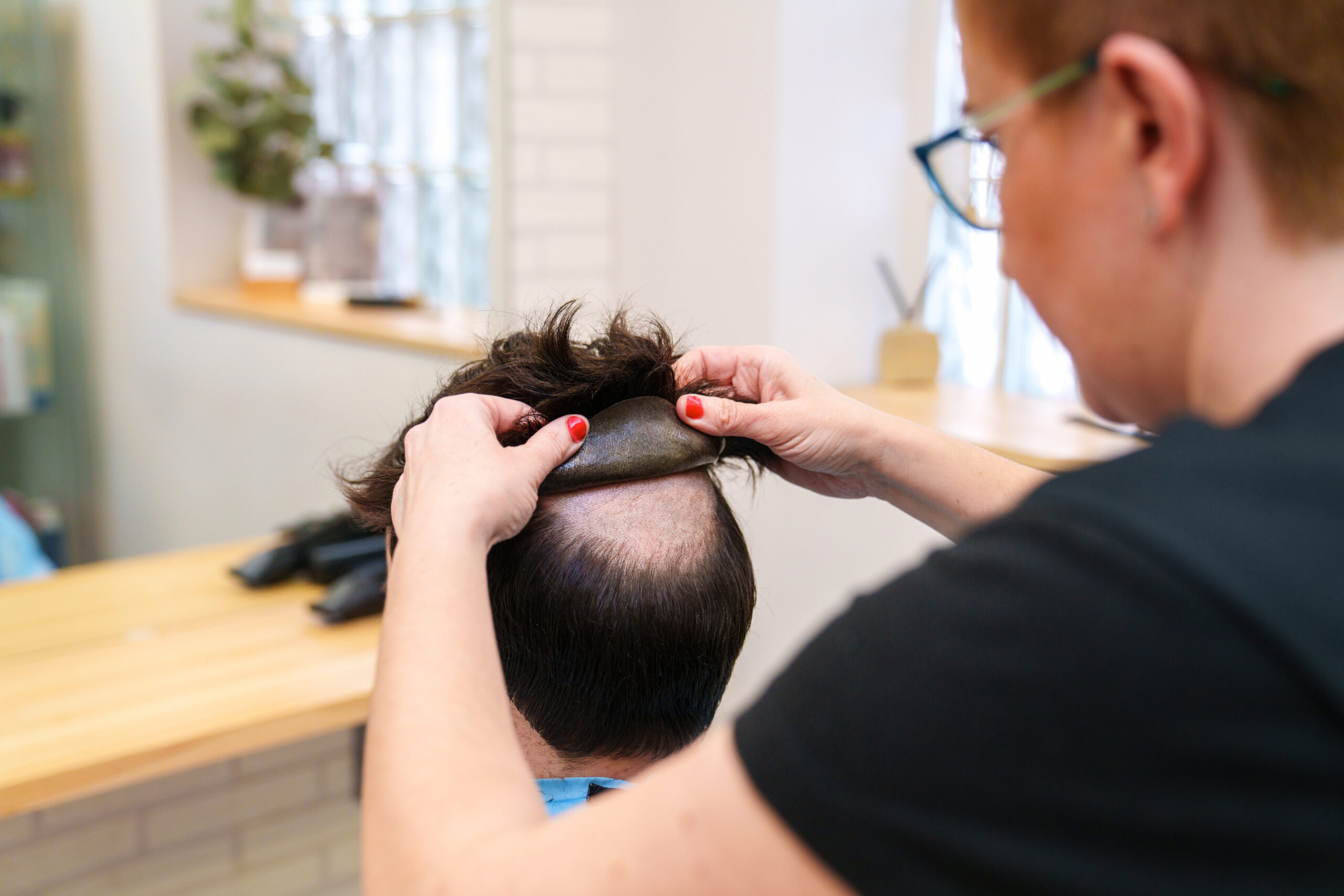 Transform Your Look Discreetly with Non-Surgical Hair Replacement at BarberNBar