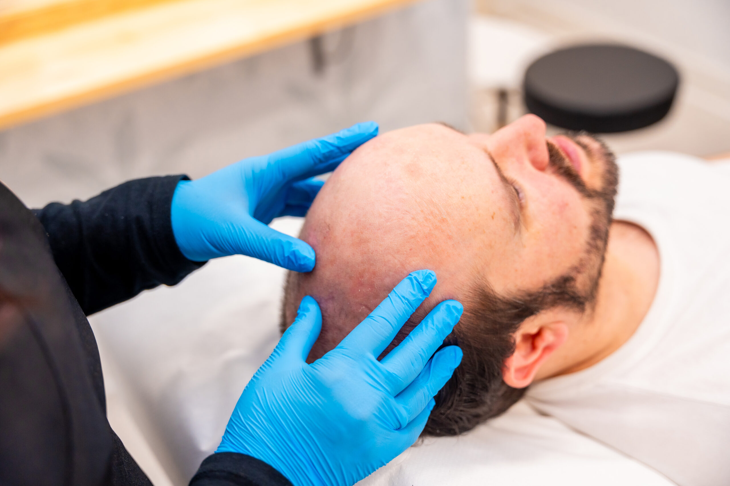 Unlock Confidence: Your Guide to Non-Surgical Hair Replacement at BarberNBar