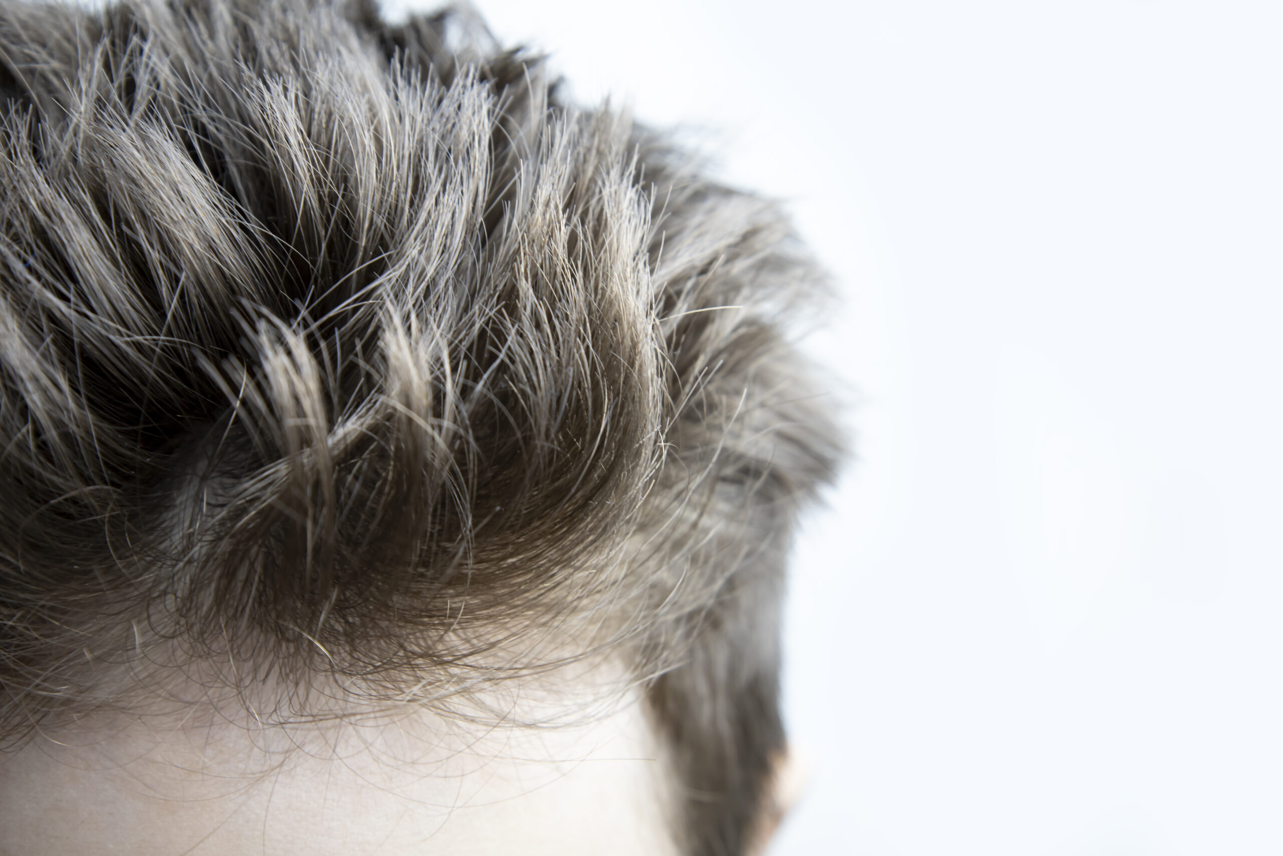 Non-Surgical Hair Replacement at BarberNBar: Natural Results, Total Privacy