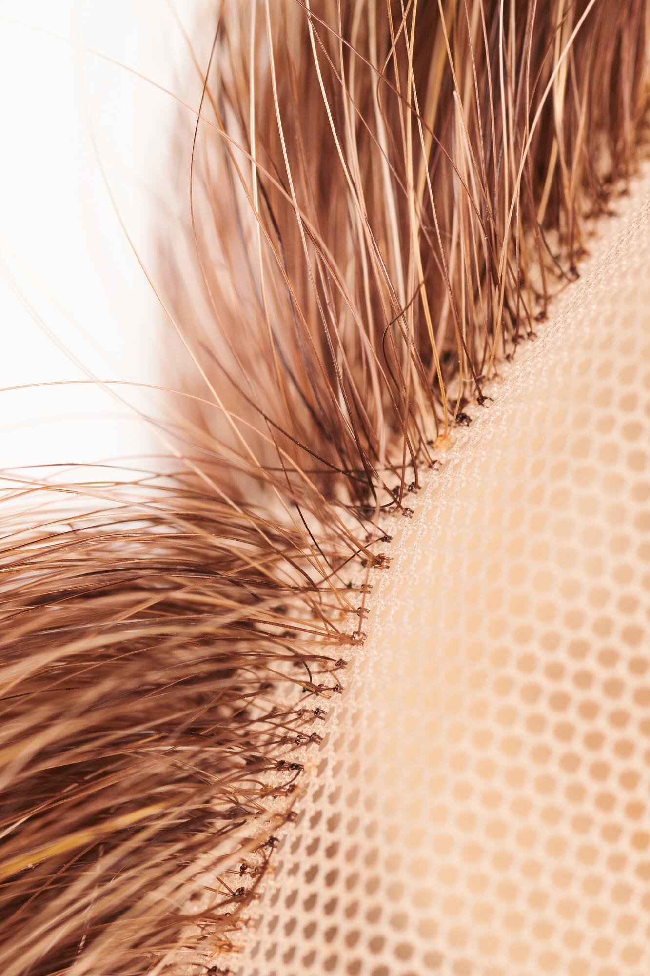 Understanding Non‑Surgical Hair Replacement: Natural Results and Total Privacy at BarberNBar Cheltenham