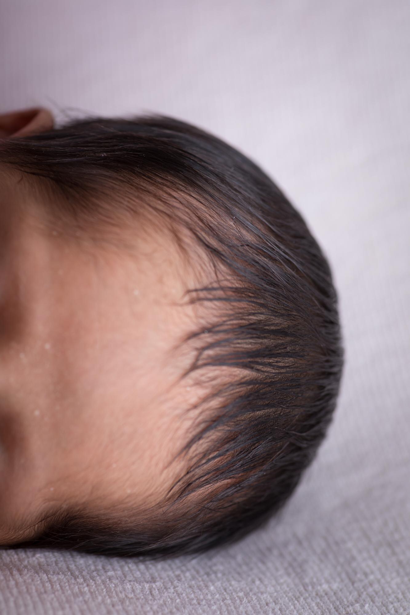 Natural Results, Real Confidence: Non-Surgical Hair Replacement in Cheltenham