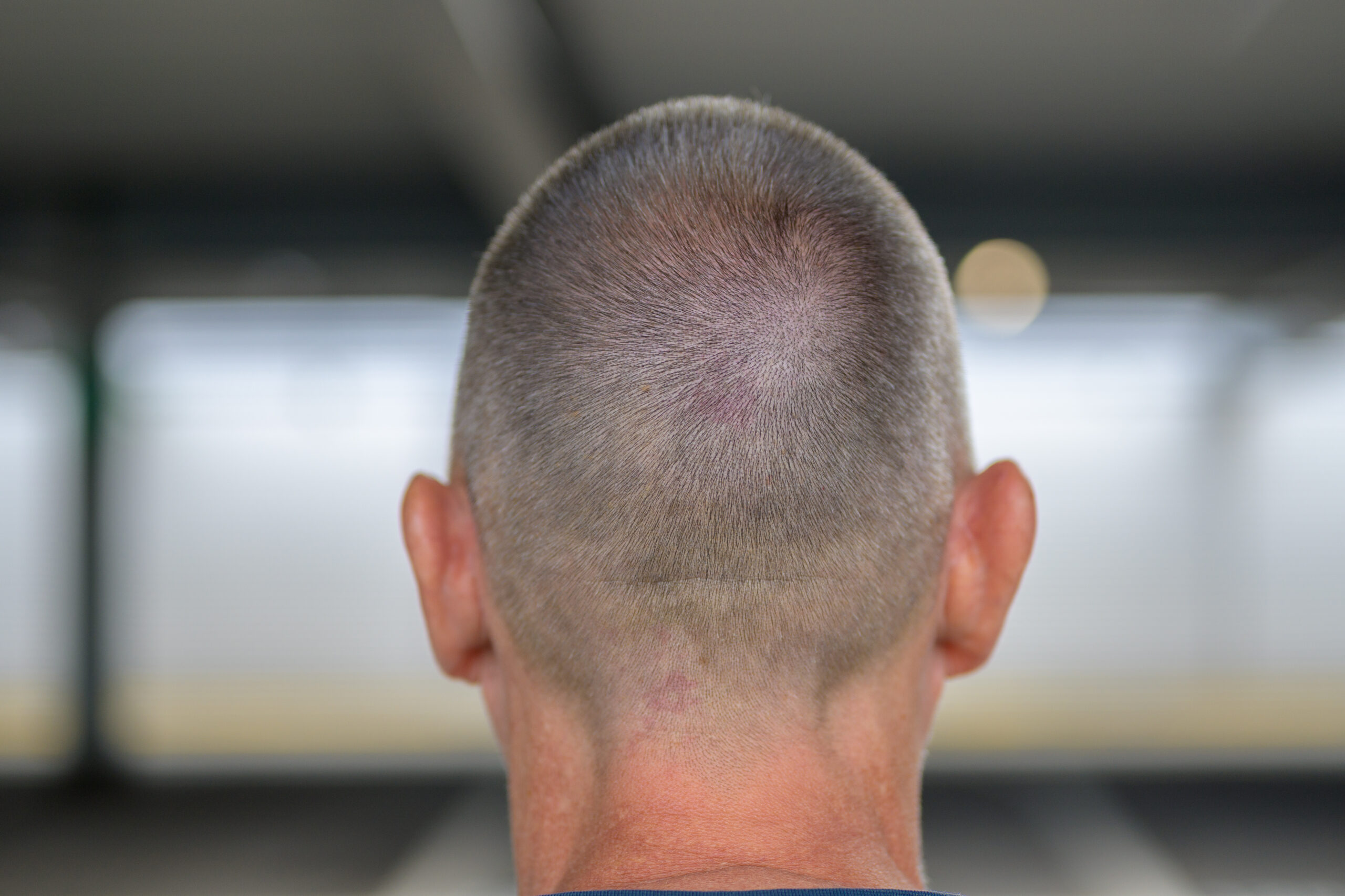 Natural-Looking Haircuts for Thinning Hair: Your Cheltenham Guide