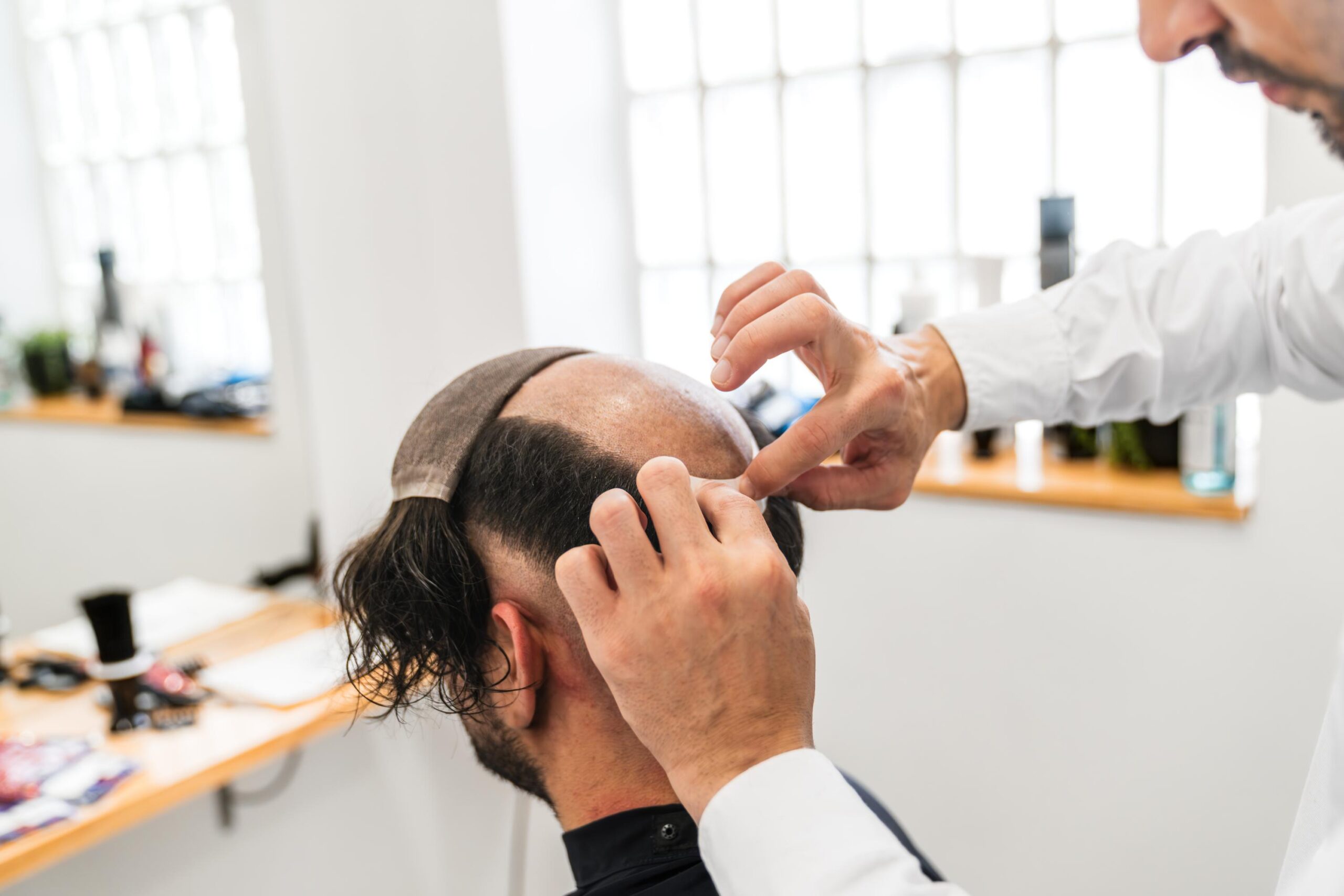 Hair Replacement Consultation in Cheltenham: What To Expect First at BarberNBar